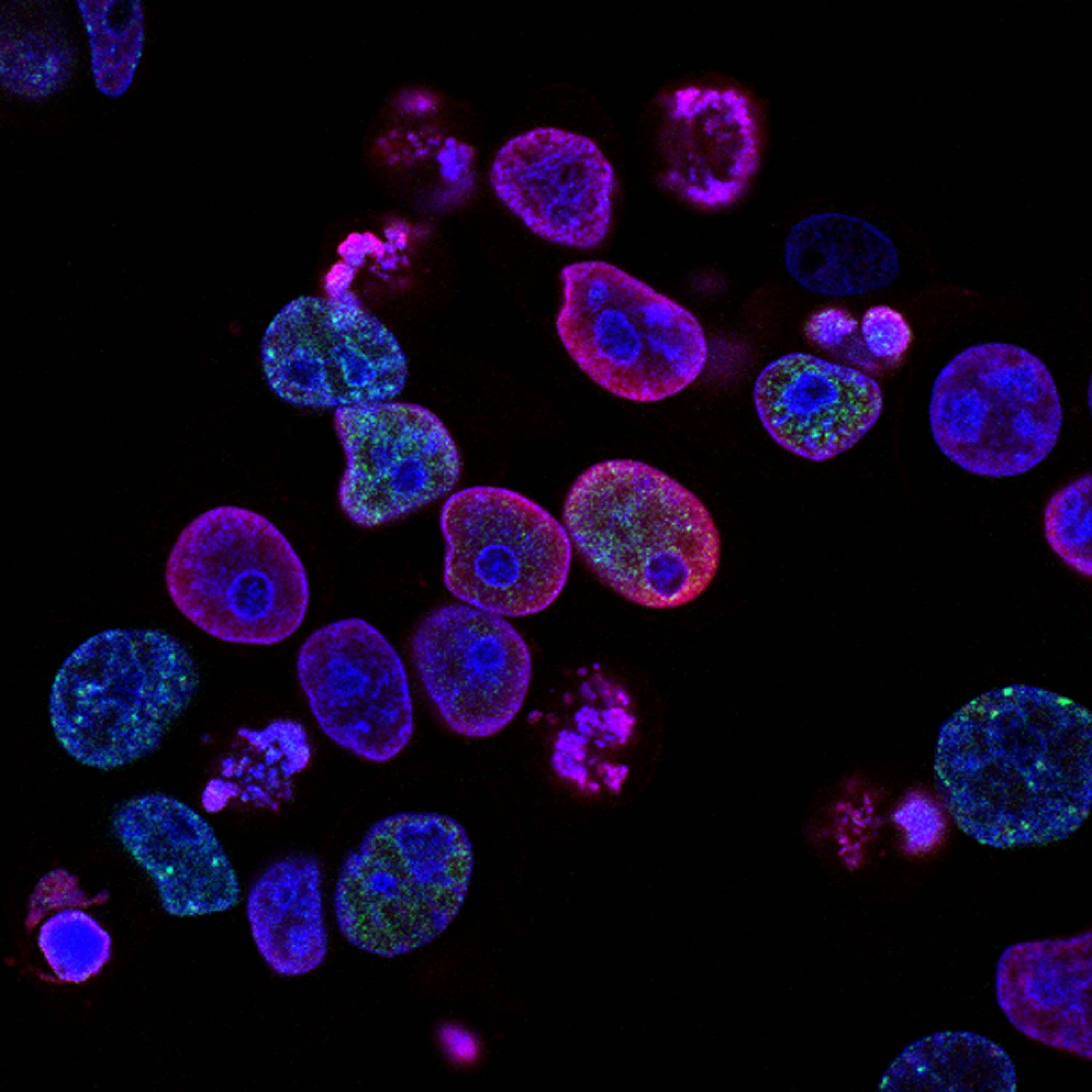 Fluorescence microscopy